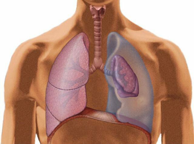 pneumothorax types emergency first aid