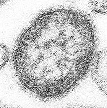 measles virus microbiology