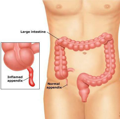 appendix is