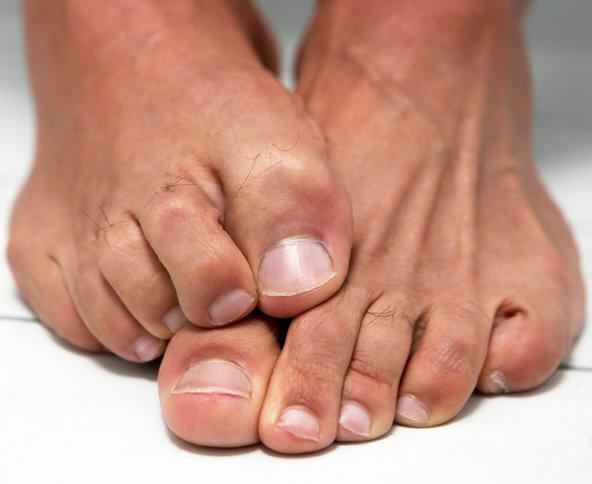 means of stop-active from foot and nail fungus