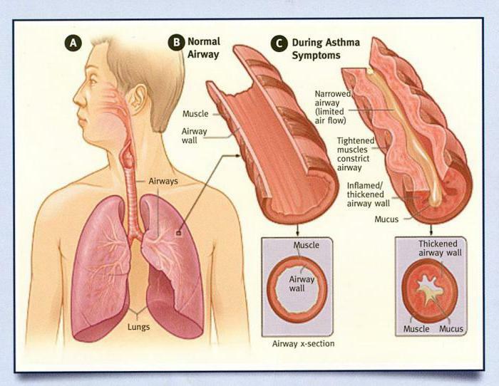 Plan expirator fără suflu pentru intervenții de îngrijire medicală