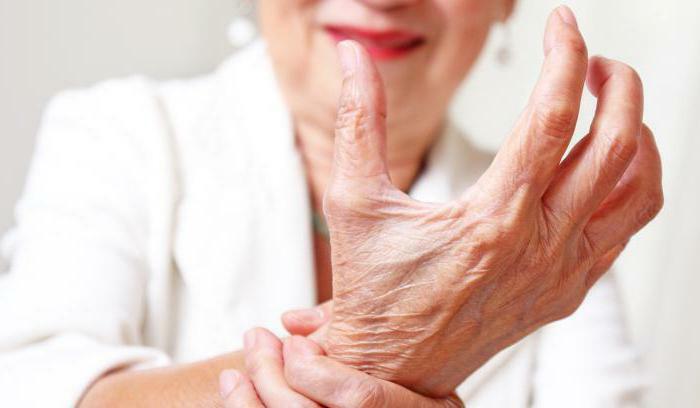 rheumatoid arthritis first symptoms