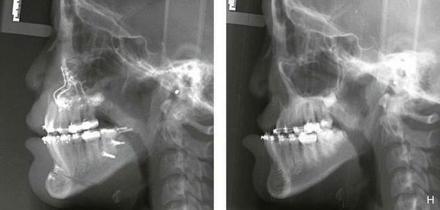 caracteristici fiziologice anatomice